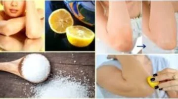 اسمرار الكوعين وداعاً.. أسرار وصفات طبيعية فعالة لإزالته نهائياً في أسبوعين